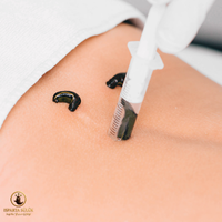 canlı sülük resmi Isparta Sülük Sağlıklı Yaşam Çiftliği